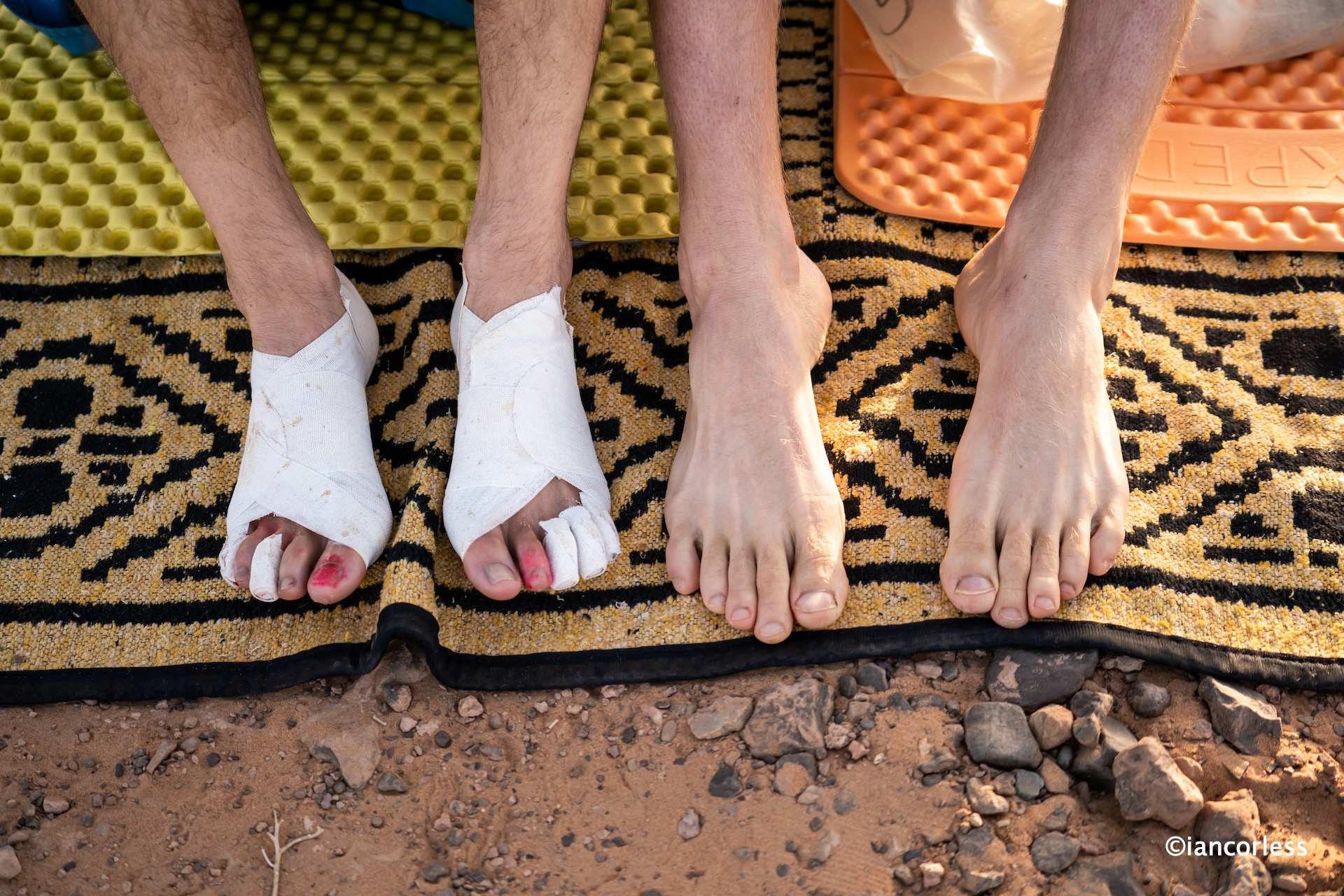 How to Put on ArmaSkin Anti-Blister Toe Socks - Blister Prevention for  Hiking 